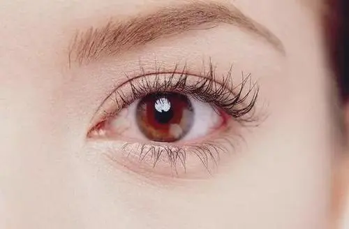 眼睛里飞进只虫子，最后到哪里去了？
