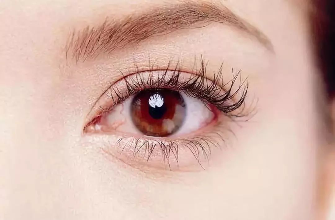秋季干眼高发，眼科专家教你如何应对 