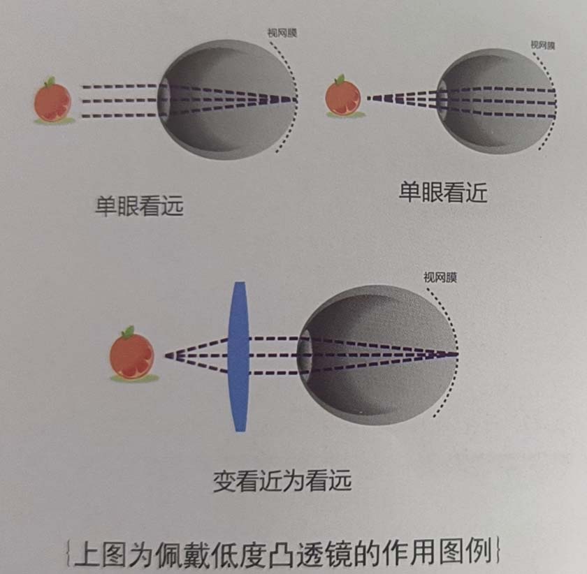 一线双光内棱透镜
